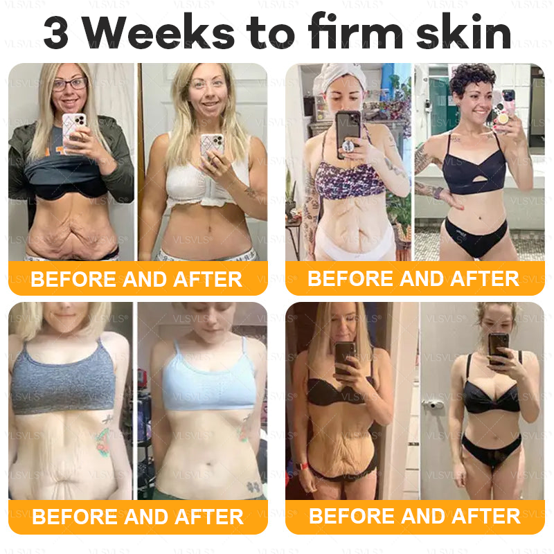 Made and Shipped from USA  🎉🎉 Bee Venom Comprehensive Cream  LAST DAY 80% OFF(Sagging Skin, Fine Lines, Loss of Firmness, Flat Bust, Drooping Hips, and More)