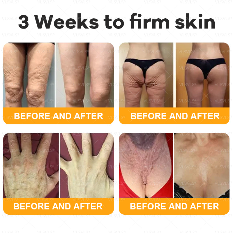Made and Shipped from USA  🎉🎉 Bee Venom Comprehensive Cream  LAST DAY 80% OFF(Sagging Skin, Fine Lines, Loss of Firmness, Flat Bust, Drooping Hips, and More)