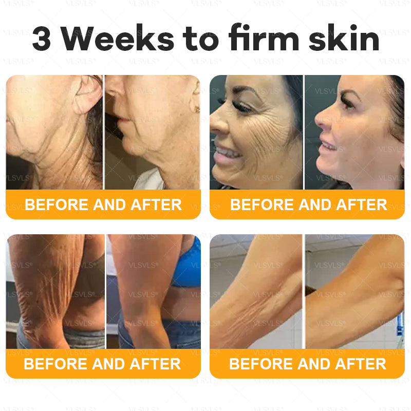 Made and Shipped from USA  🎉🎉 Bee Venom Comprehensive Cream  LAST DAY 80% OFF(Sagging Skin, Fine Lines, Loss of Firmness, Flat Bust, Drooping Hips, and More)